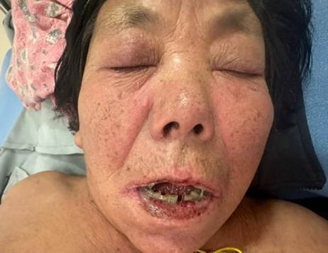 A person with broken teeth
AI-generated content may be incorrect.